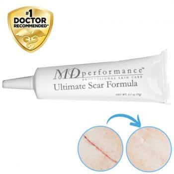 Ultimate Scar Formula - MD Performance Silicone Scar Removing Gel