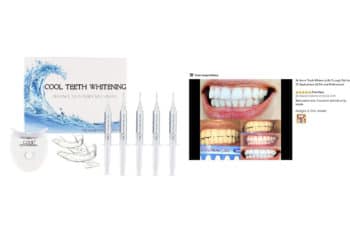 Professional Teeth Whitening Kit